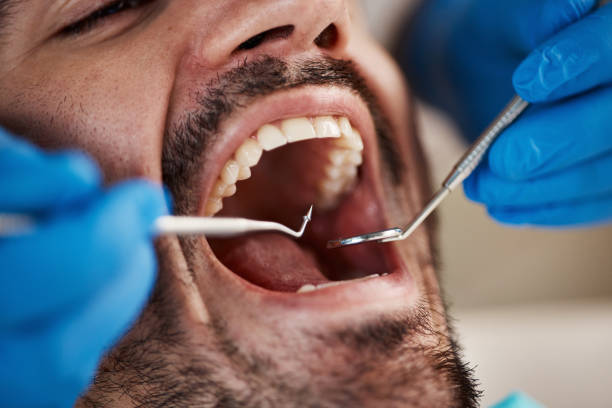 Best Walk-In Emergency Dental Services in Marienville, PA