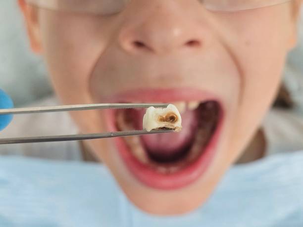 Best Emergency Cosmetic Dentistry (e.g., broken veneers) in Marienville, PA